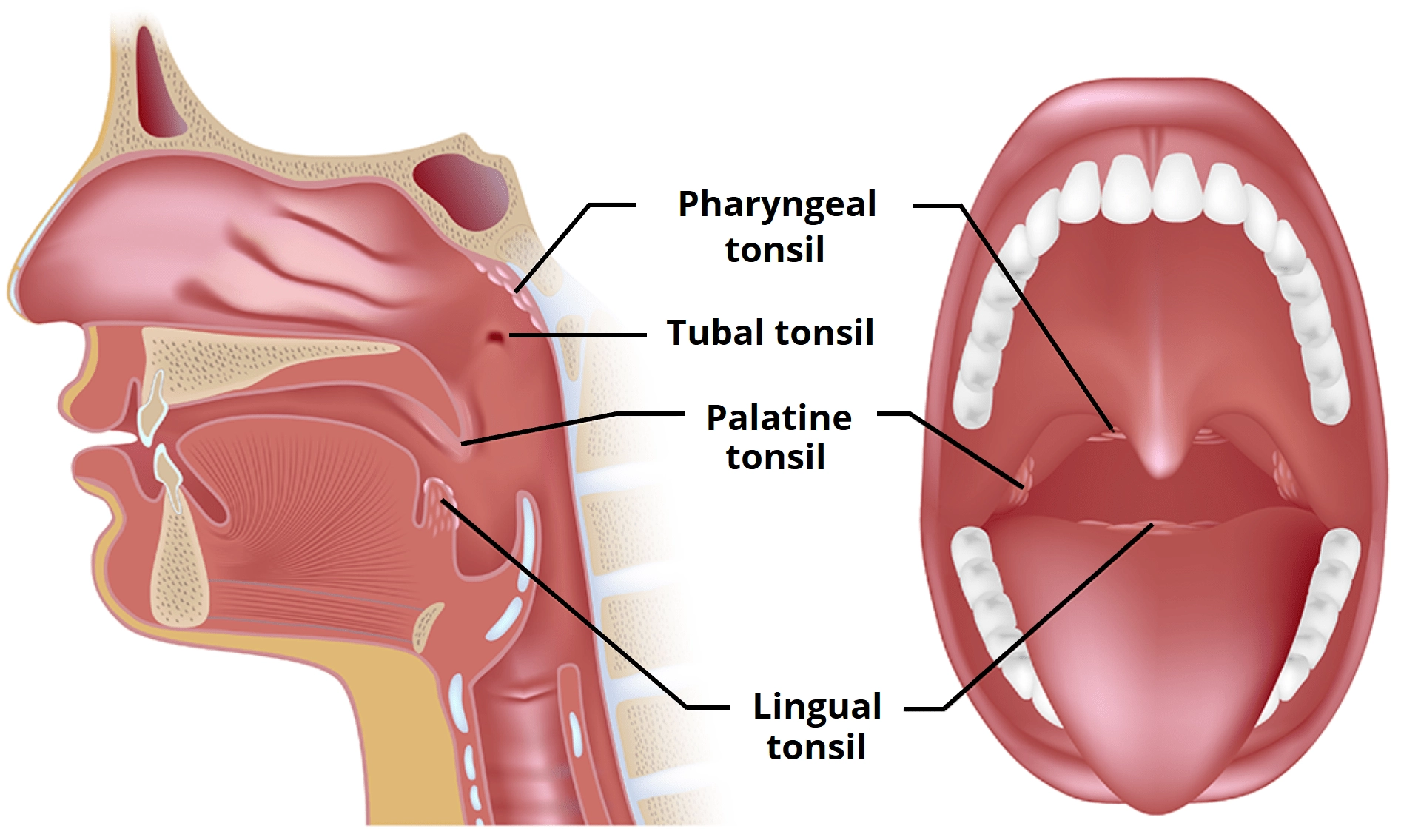 four-sets-of-tonsils