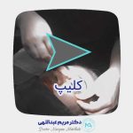 زیبایی پلک